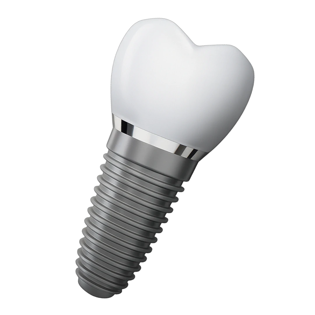 Implantes dentales · Centro de Soluciones Dentales